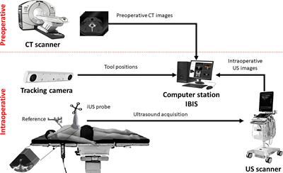 Evaluation of an Ultrasound-Based Navigation System for Spine Neurosurgery: A Porcine Cadaver Study